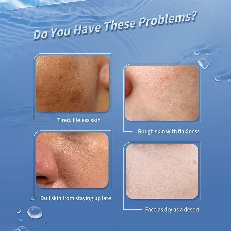 Ultra-Hydration-Brightening-Mask-Problems
